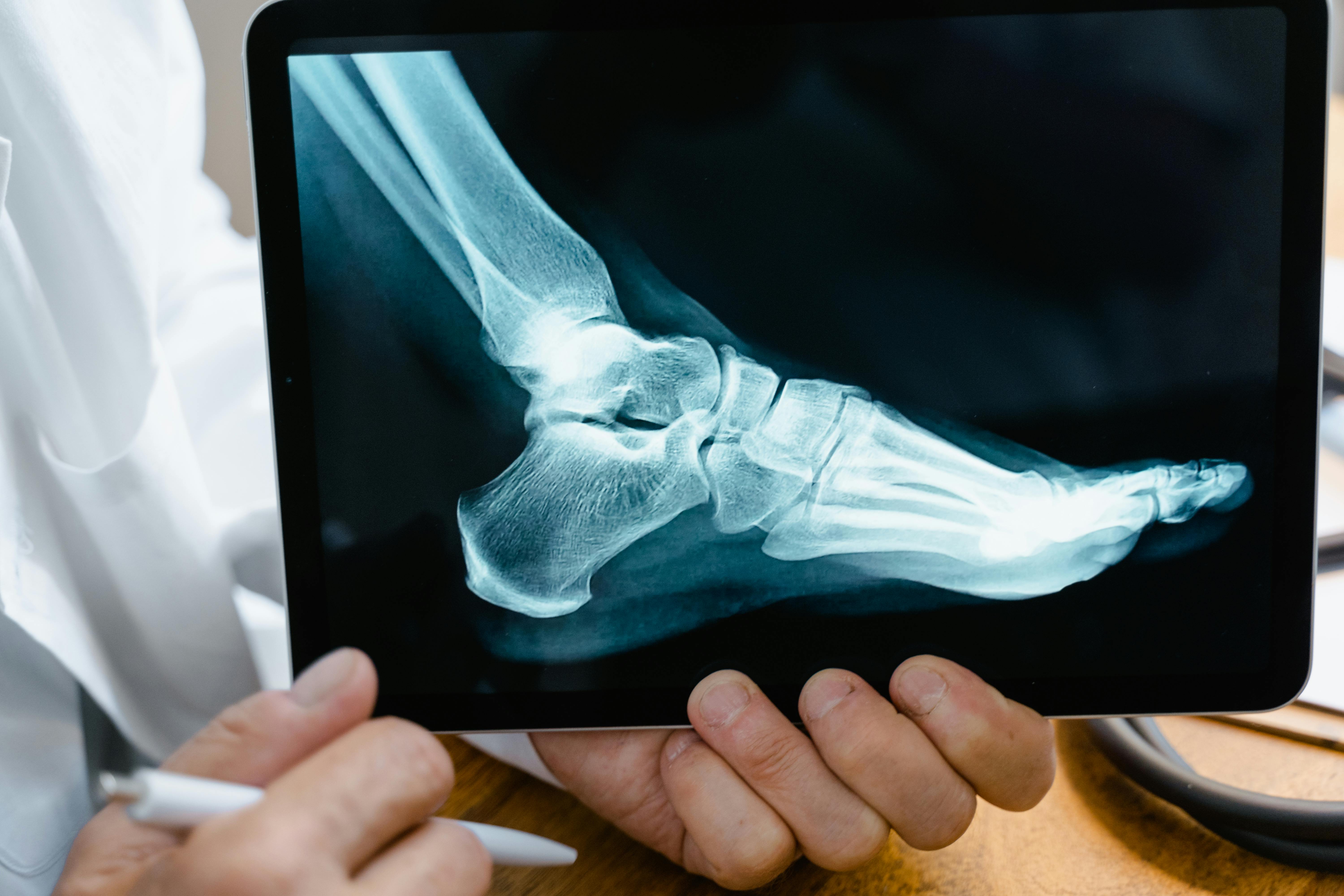 Foot X-Ray